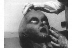 AUTOPSY1