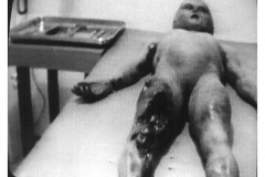 AUTOPSY3